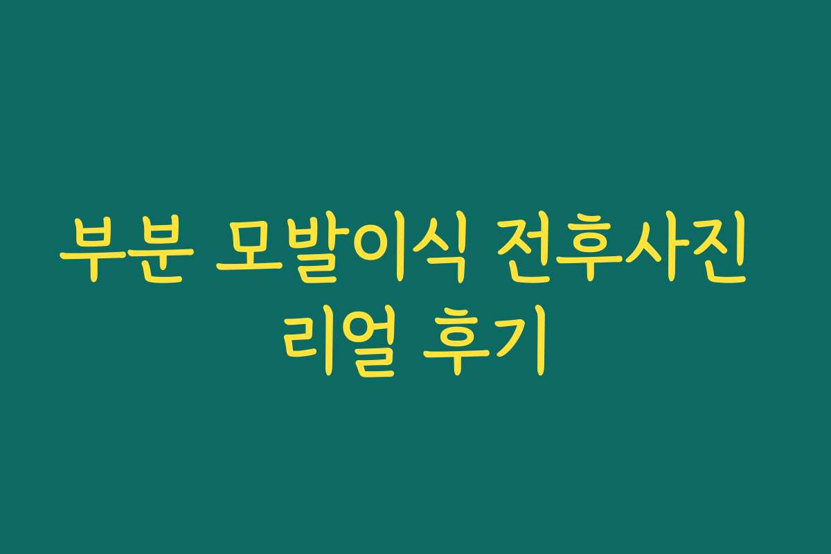 부분 모발이식 전후사진 리얼 후기